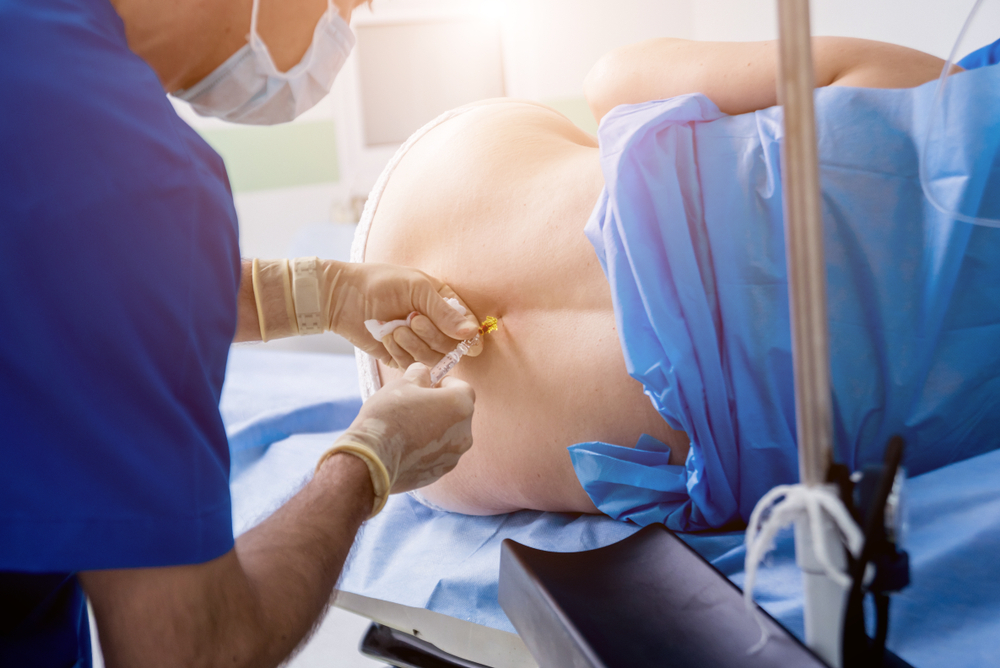 Anesthesia Errors