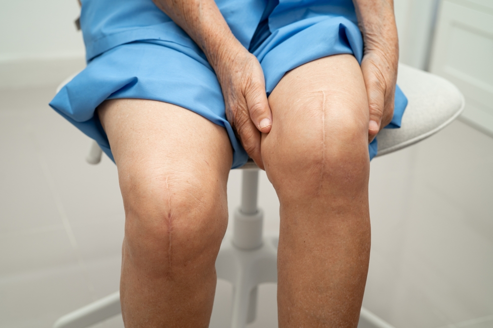Common Injuries from Defective Medical Devices