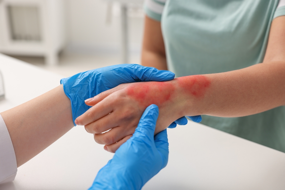 How to Prove an Appliance Malfunction Caused Injury